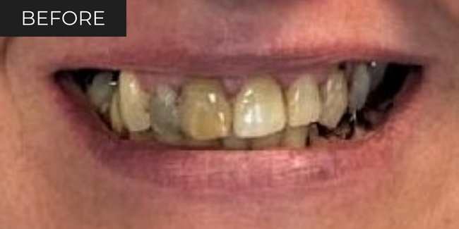 5-before