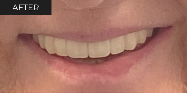 6-after