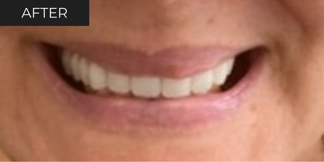9-after