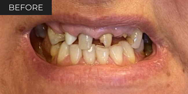 9-before