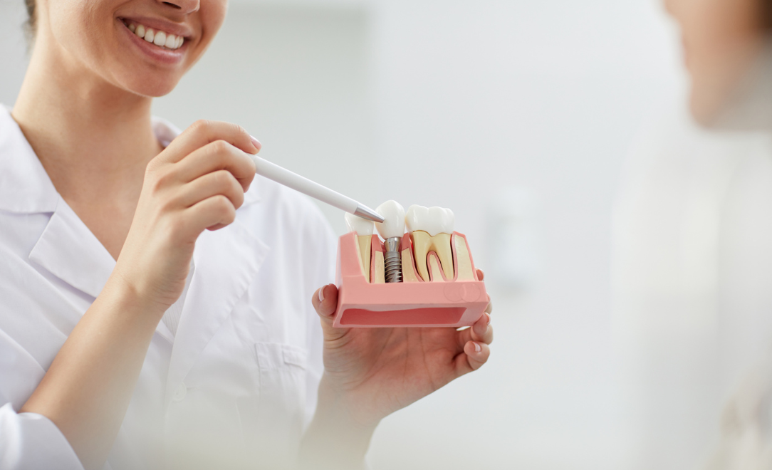 Dentist showing how to care for dental implants