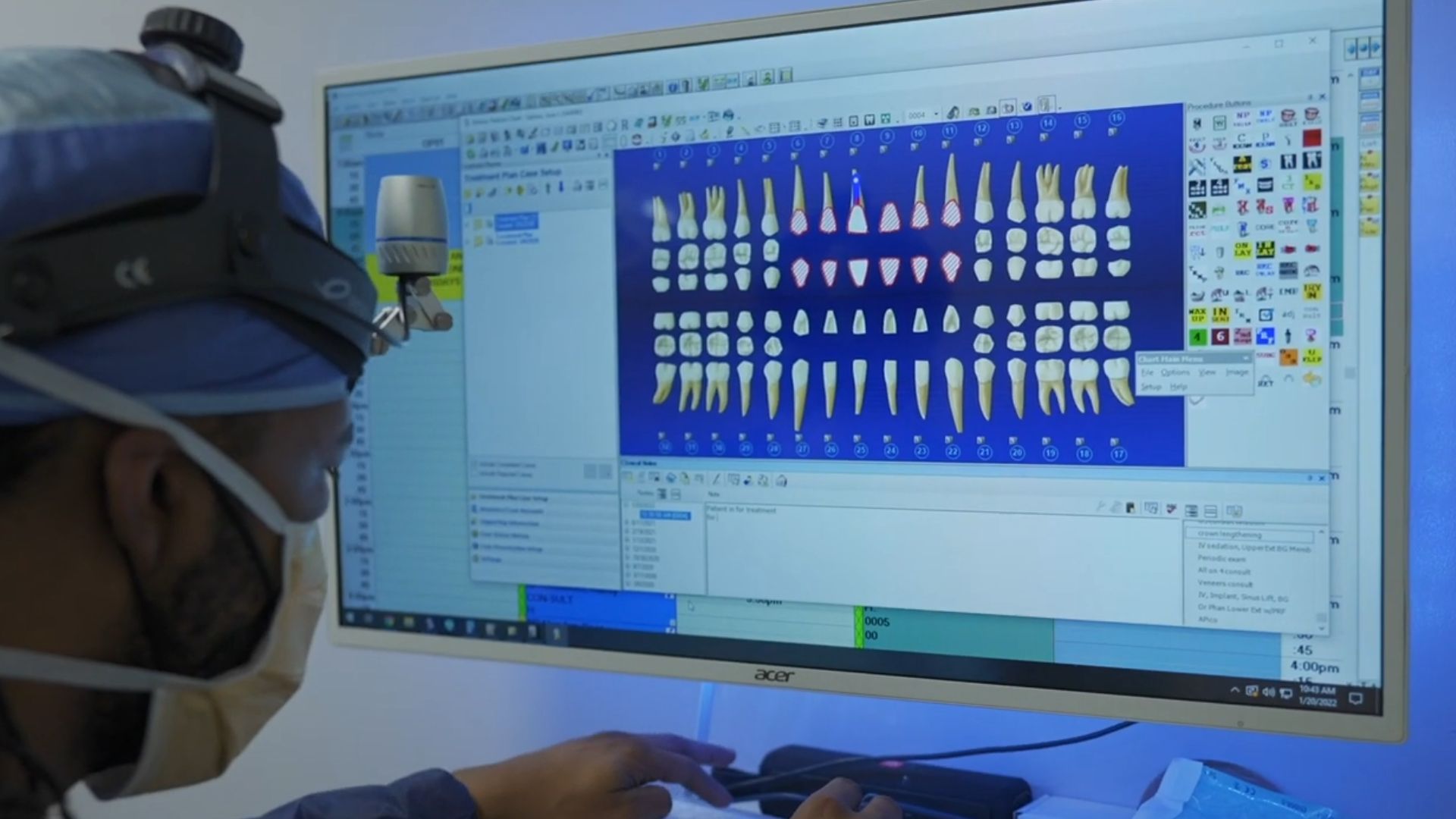 Dental Implant Treatment Planning