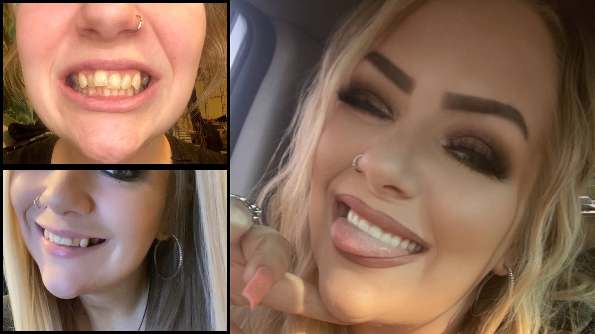 MDS_TikTok_Influencer_Stacy_Before_After